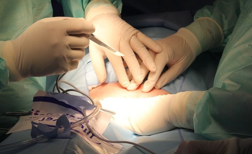 Bailar para salvar vidas: La Sonora Santanera y el Club Rotario se unen por los trasplantes de riñón