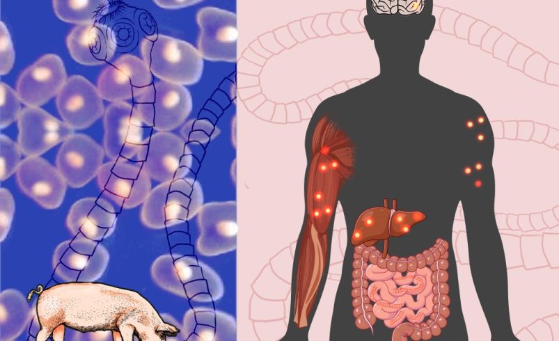 El complejo ciclo de vida del párasito La Solitaria, un desafío médico y social