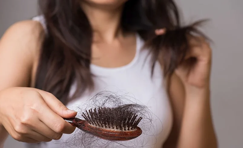 La caída del pelo, la gran obsesión estética de hombres y mujeres.