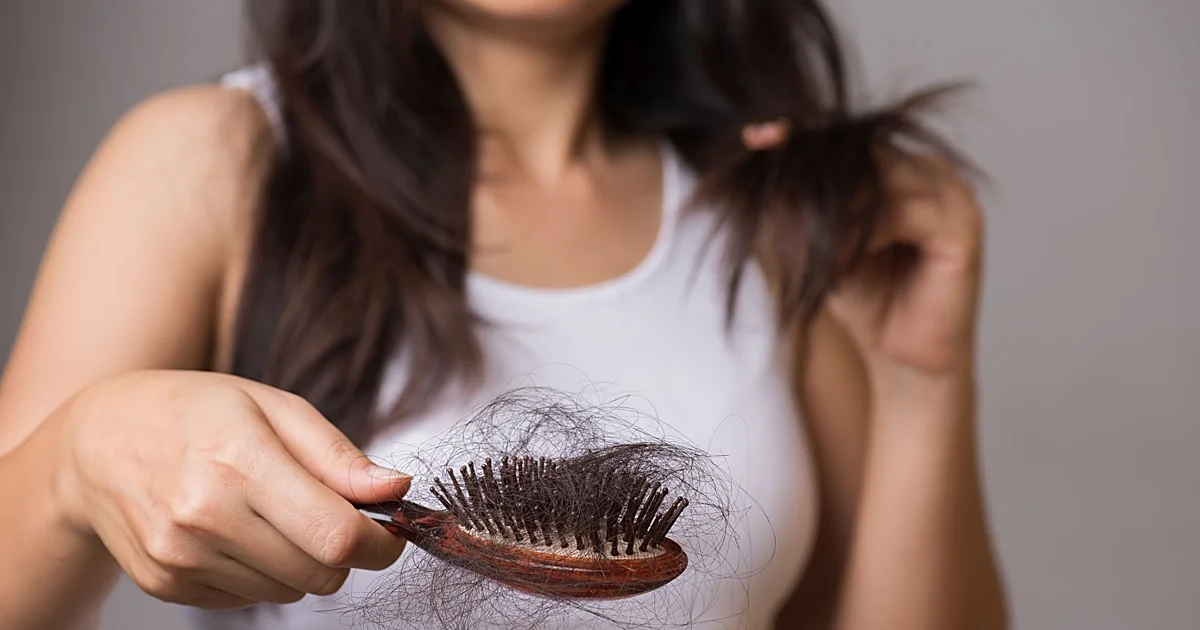 La caída del pelo, la gran obsesión estética de hombres y mujeres.