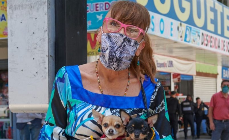 “Sobrevivo tomada de la mano de Dios”. Mujer relata las dolorosas secuelas que le dejaron los aceites modelantes